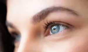 Brow Tattoo Removal at Amplif'eyed